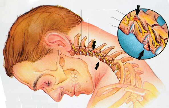 A estrutura das vértebras cervicais